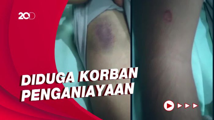Napi Anak di Lampung Tewas Diduga Dianiaya hingga Lumpuh