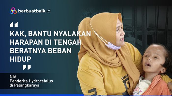 Derita Anak Yatim Hidrosefalus Selalu Digendong Ibunya Berjualan Keripik