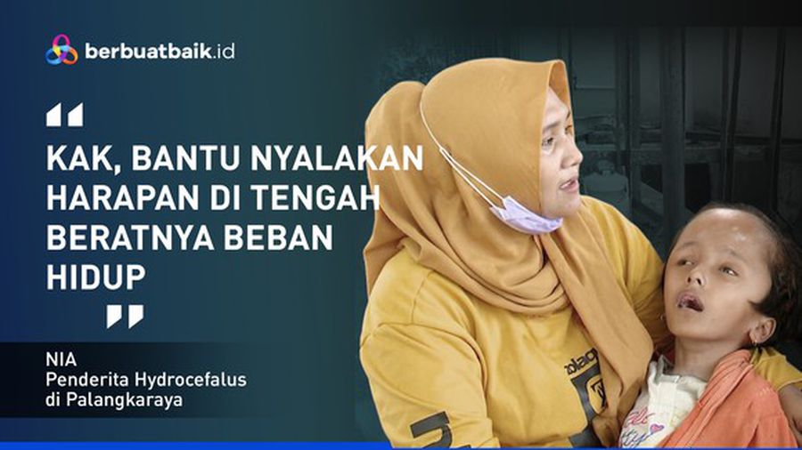 Derita Anak Yatim Hidrosefalus Selalu Digendong Ibunya Berjualan Keripik