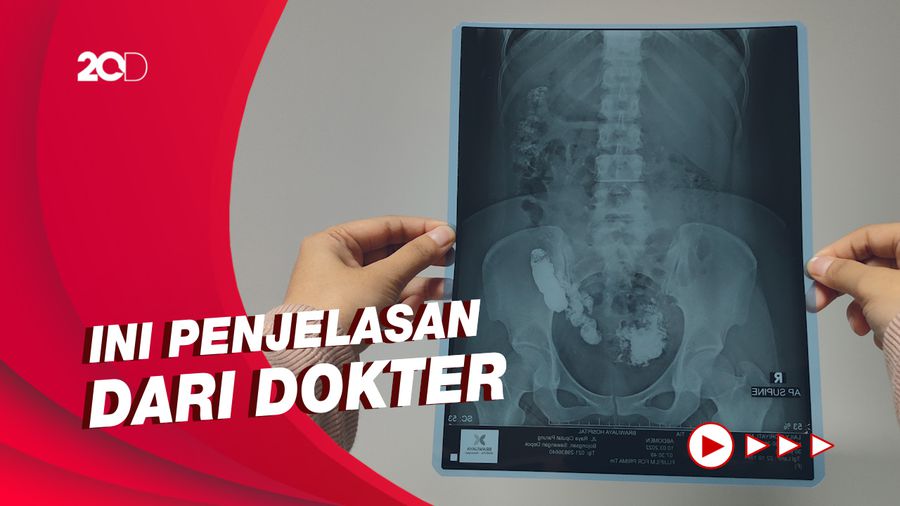 Gerakan Salat Dapat Bantu Percepat Terapi Nyeri Pinggang