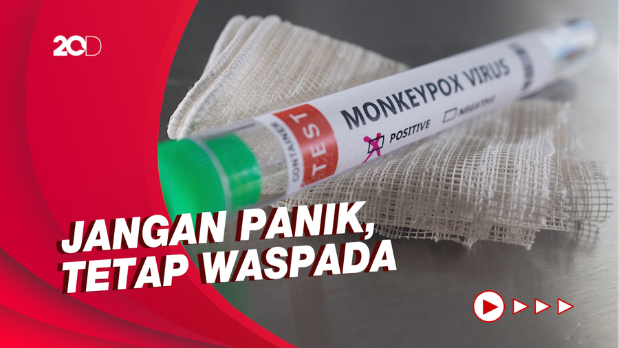 Cacar Monyet Darurat Global, Epidemiolog Jelaskan Cara Menghindarinya