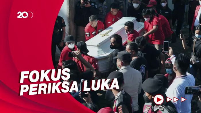 Tim Forensik Selesai Autopsi Brigadir J, Ini yang Jadi Fokus Pemeriksaan
