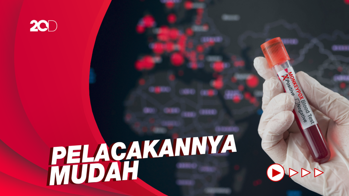 Budi Gunadi Sebut Cacar Monyet Tak Masuk Pandemi