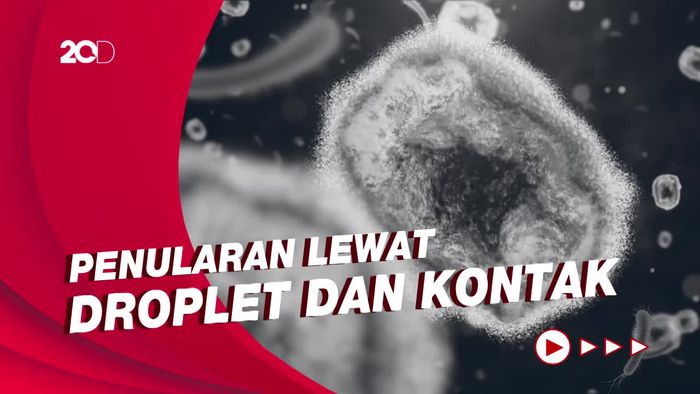 Kemenkes: Cacar Monyet Bukan Penyakit Menular Seksual