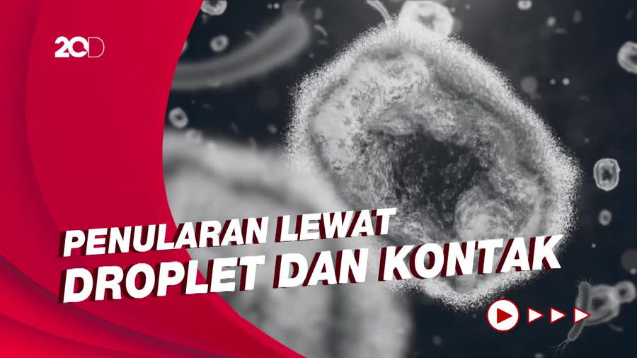 Kemenkes: Cacar Monyet Bukan Penyakit Menular Seksual