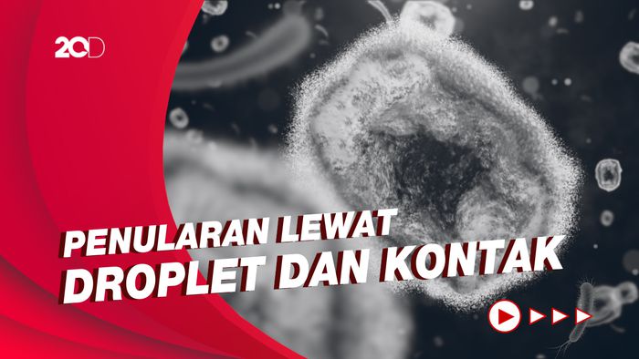 Kemenkes: Cacar Monyet Bukan Penyakit Menular Seksual