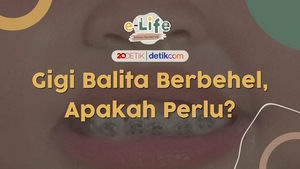 Gigi Balita Berbehel, Apakah Perlu?