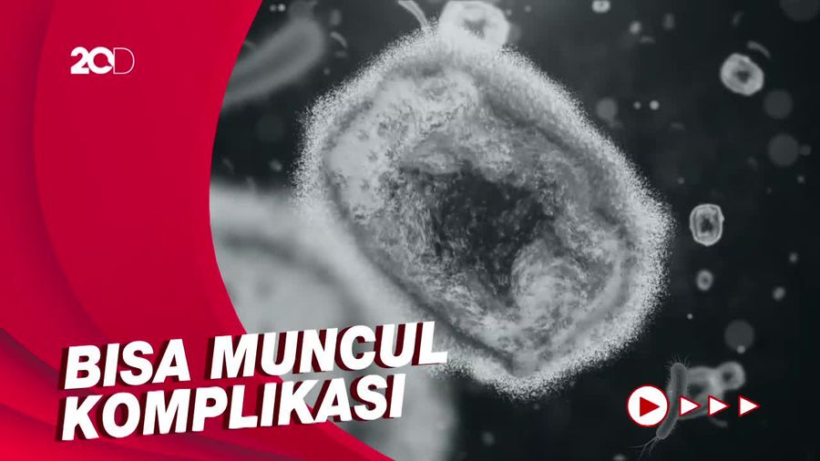Apakah Cacar Monyet Bisa Menyebabkan Kematian?