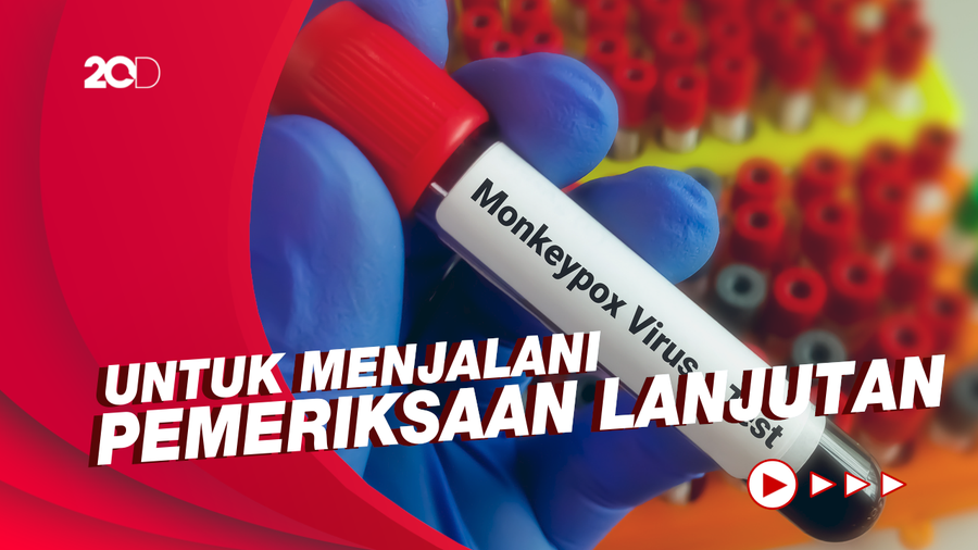 Suspek Cacar Monyet di Jateng Masih Menjalani Isolasi