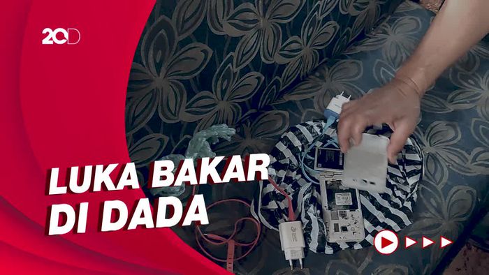 Bocah SD di Ciamis Tewas di Rumahnya Diduga Karena Ponsel Meledak