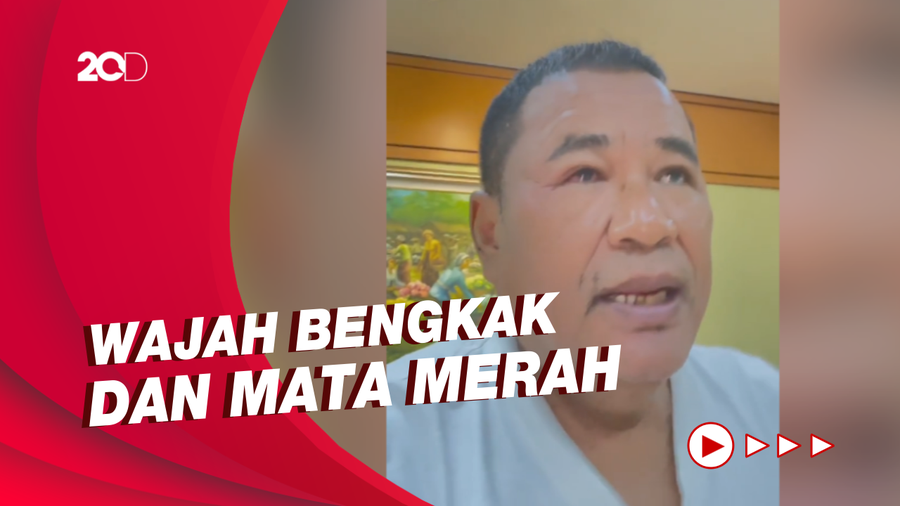 Kondisi Hotman Paris yang Dibawa ke UGD Gegara Keracunan Obat