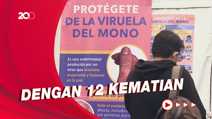 WHO: 35 Ribu Kasus Cacar Monyet Terlapor dari 92 Negara