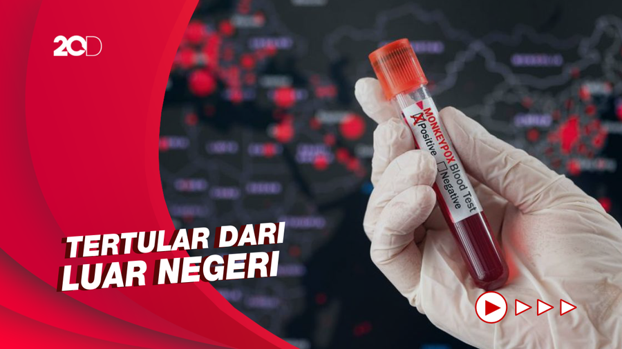 Fakta-fakta Kasus Cacar Monyet Pertama di Indonesia