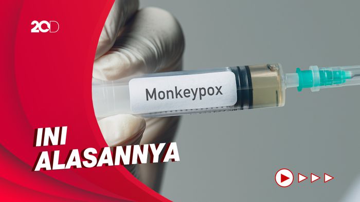 Pasien Cacar Monyet Pertama RI Isoman di Rumah