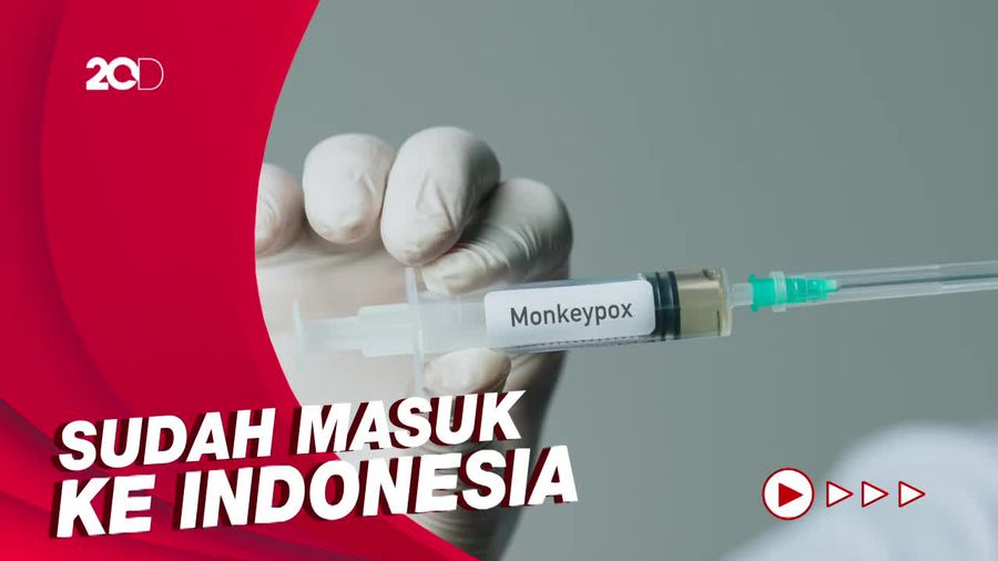 Kenali Lagi Tanda dan Gejala Cacar Monyet