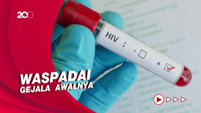 Seputar 414 Mahasiswa KTP Bandung Terinfeksi HIV/AIDS