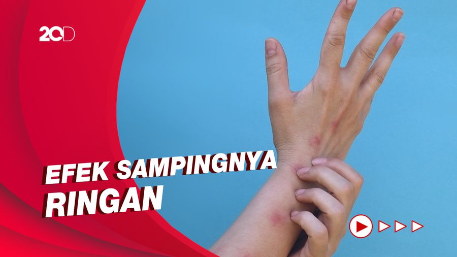 Epidemiolog: Vaksin MVA untuk Cacar Monyet Jauh Lebih Aman