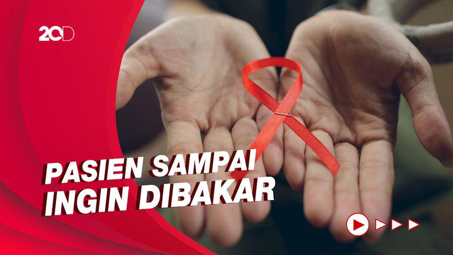 Pengalaman Penemu Pertama HIV di RI Obati ODHA di Tahun 1985-1995