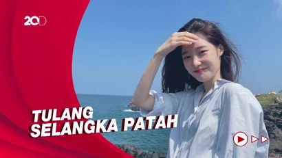 Kondisi Jung Chaeyeon Usai Jatuh dari Tangga Saat Syuting The Golden Spoon