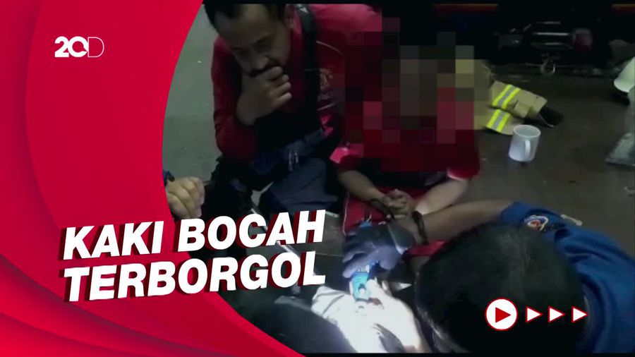 Kaki Bocah di Jaktim Terborgol Besi, Damkar Turun Tangan