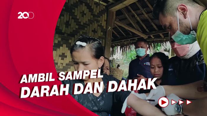 Kemenkes Pantau Warga Baduy yang Diduga Terjangkit TBC dan Campak