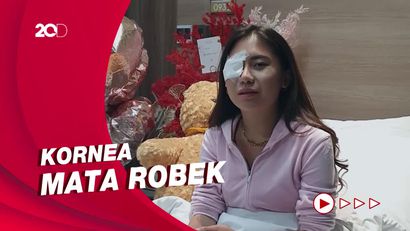 Cerita Ayu Thalia Tak Hadir di Sidang karena Kecelakaan saat Syuting