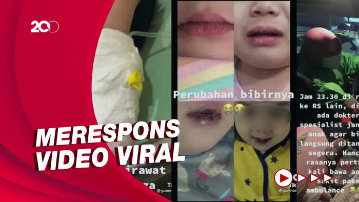 Dirut BPJS Pastikan Pengobatan Penyakit Kawasaki Ditanggung BPJS