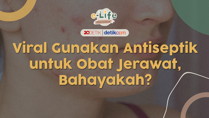 Gunakan Antiseptik Untuk Obat Jerawat, Bahayakah?