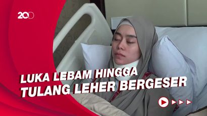 Polisi Ungkap Sejumlah Luka yang Dialami Lesti Kejora