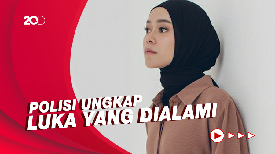 Kondisi Terkini Lesti Kejora Usai Diduga Alami KDRT oleh Rizky Billar