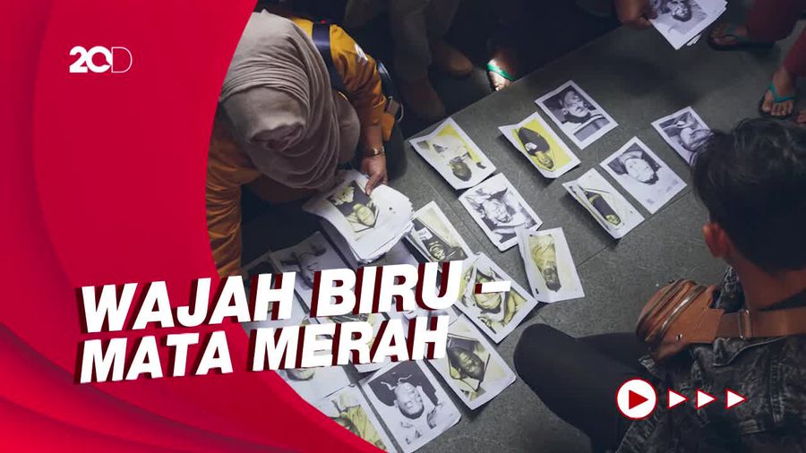Komnas HAM Ungkap Kondisi Memprihatinkan Korban Tragedi Kanjuruhan