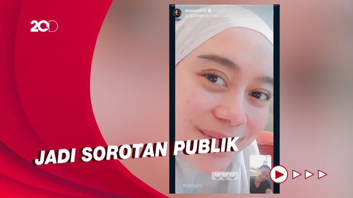 Mata Sembab Lesti Kejora Dalam Unggahan Rossa