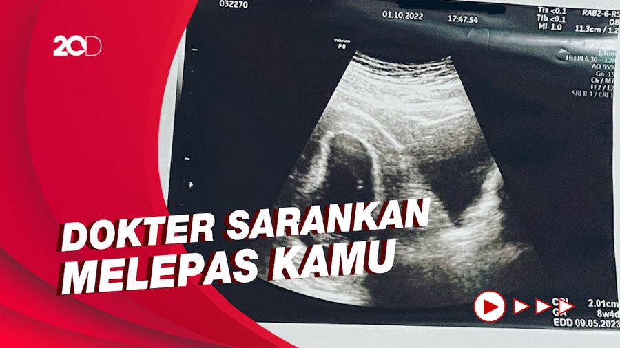 Curhatan Via Vallen soal Kehamilan Anak Pertama