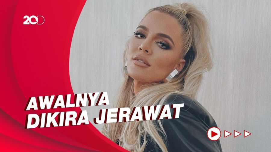 Curhat Khloe Kardashian Usai Jalani Operasi Tumor di Wajah