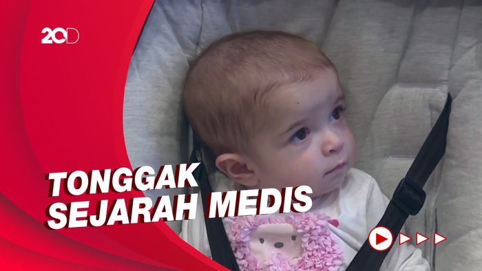 Spanyol Berhasil Lakukan Transplantasi Usus Bayi Pertama di Dunia
