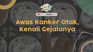 Awas Kanker Otak, Kenali Gejalanya