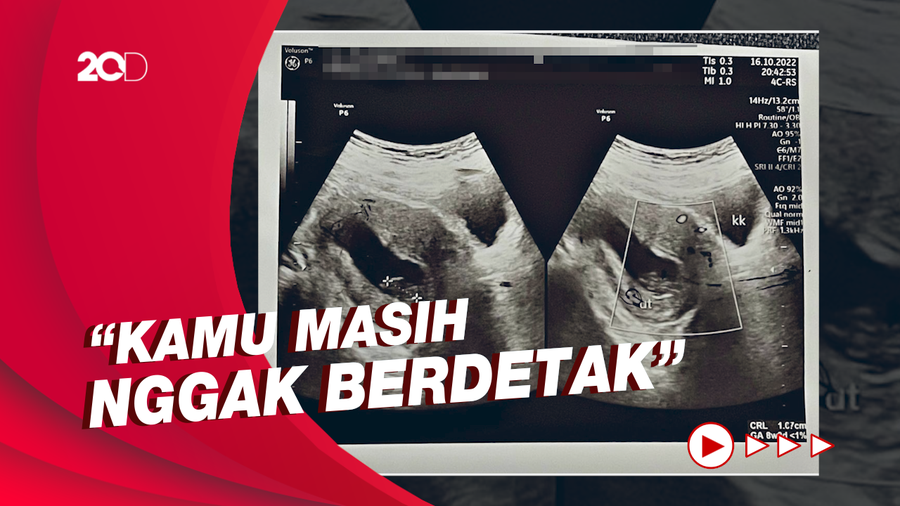 Curahan Hati Via Vallen soal Janin yang Tidak Berkembang