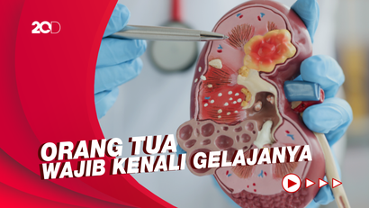 Informasi Penanganan Gejala Gagal Ginjal Akut untuk Balita