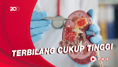 Tingkat Kematian Gangguan Ginjal Akut Capai 48 Persen, Mengapa?