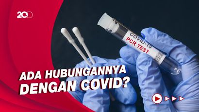 Kemenkes Tanggapi Pernyataan Siti Fadilah Supari Soal Penyebab Gagal Ginjal Akut