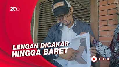 Andri Irawan Ngaku Sempat Alami KDRT dari Roro Fitria