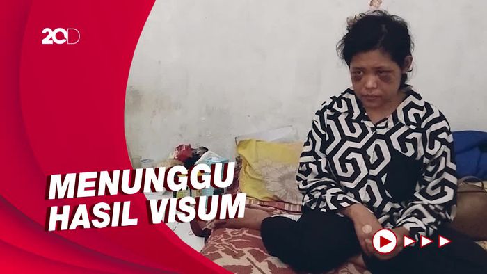 Rohimah ART yang Disekap Bakal Bersaksi di Polres Cimahi Minggu Depan