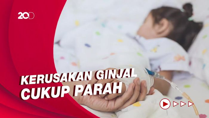Kondisi 14 Anak yang Masih Dirawat di RSCM Karena Gagal Ginjal Akut
