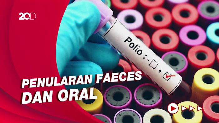 Lingkungan Tercemar Tinja Jadi Penyebab Penyakit Polio