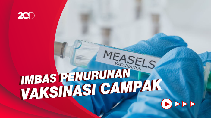 Laporan WHO dan CDC: Hampir 40 Juta Anak Rentan Terkena Campak