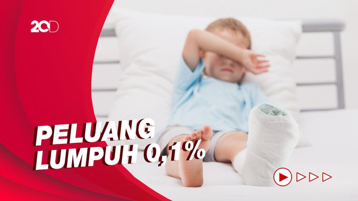 Virus Polio Tak Selalu Sebabkan Kelumpuhan