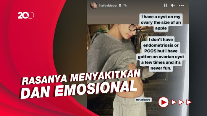 Hailey Bieber Ungkap Idap Kista Ovarium Sebesar Buah Apel