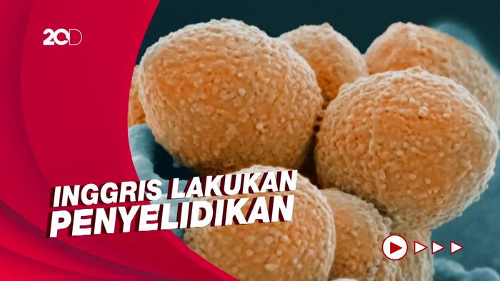 Enam Anak di Inggris Meninggal Dunia Akibat Infeksi Bakteri Strep A