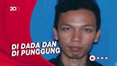 Agus Sujatno Bawa 2 Ransel Berisi Bom saat Ledakkan Diri di Bandung