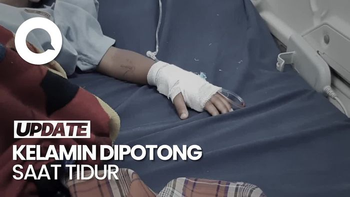 Fakta-fakta Kelamin Bocah di Tasikmalaya Dipotong Ayah saat Tidur